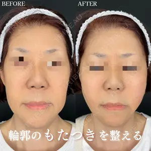 ルラ美容クリニック 東京駅前院 山本 泰輔医師の症例