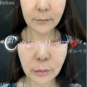 ルラ美容クリニック 札幌院の症例