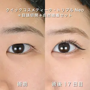 湘南美容クリニック 銀座院の症例