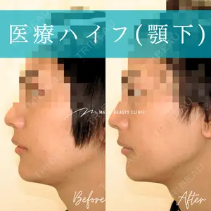 Mavie Beauty Clinic （マヴィービューティークリニック）の症例