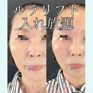 ルラ美容クリニック 渋谷本院 武内 大医師の症例
