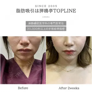 狎鴎亭トップライン医院の症例
