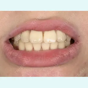 池袋麗歯科・美容皮膚科の症例