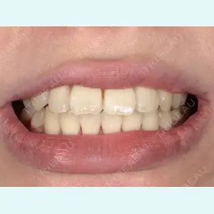 池袋麗歯科・美容皮膚科の症例