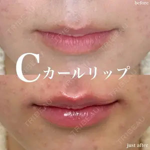 ルラ美容クリニック 名古屋栄院 関戸 優医師の症例