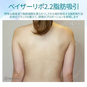 聖心美容クリニック 札幌院 前多 一彦医師の症例