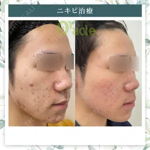 オラクル美容皮膚科 名古屋院の症例