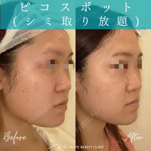 Mavie Beauty Clinic （マヴィービューティークリニック）の症例