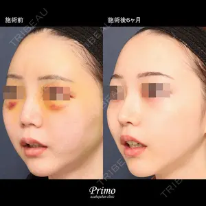 プリモ麻布十番クリニック 大場教弘医師の症例