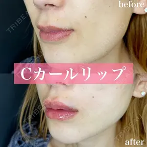 ルラ美容クリニック 岐阜院 馬場 愛理医師の症例