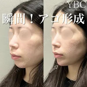 YBC横浜美容外科 大宮院 磯村 亮輔医師の症例