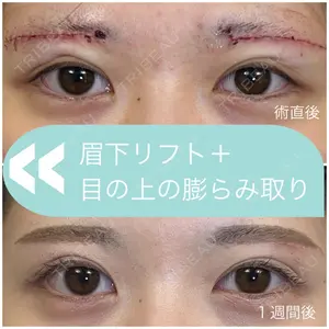 THE FIRST CLINIC 多摩センター院 惟村 公郁医師の症例