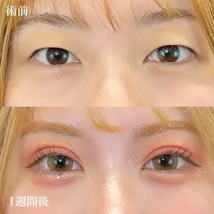 症例