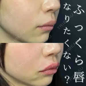 ルラ美容クリニック 高田馬場院 若佐 卓矢医師の症例