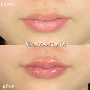 ルラ美容クリニック 町田院 小松 正樹医師の症例