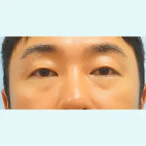 麹町皮ふ科・形成外科クリニックの症例