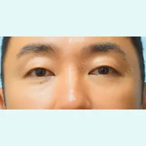 麹町皮ふ科・形成外科クリニックの症例