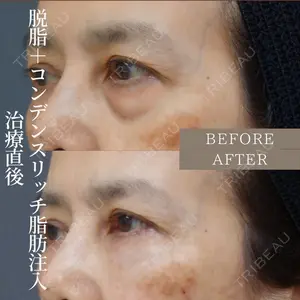 ルーチェクリニック 銀座院 加藤晴之輔医師の症例