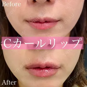 ルラ美容クリニック 渋谷本院 昼間 路子医師の症例