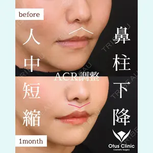 Otus Clinic 【オータスクリニック】 中 徳太郎医師の症例
