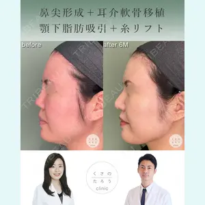 くさのたろうクリニック 住永　莉華子医師の症例