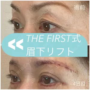 THE FIRST CLINIC 多摩センター院 惟村 公郁医師の症例