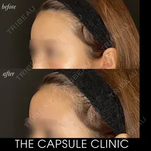 THE CAPSULE CLINIC（ザ カプセルクリニック）の症例