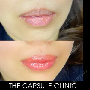 THE CAPSULE CLINIC（ザ カプセルクリニック） 小泉ヨシミ医師の症例