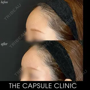 THE CAPSULE CLINIC（ザ カプセルクリニック）の症例