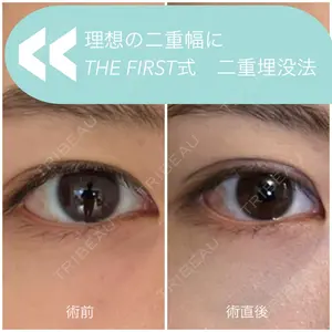 THE FIRST CLINIC 多摩センター院 惟村 公郁医師の症例