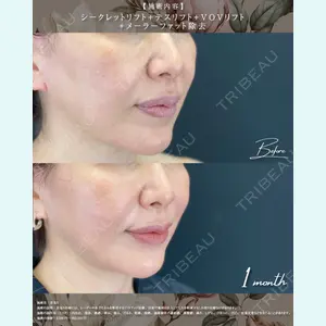 湘南美容クリニック 松戸院の症例