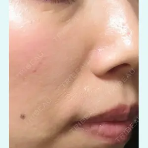 プルージュ美容クリニック 岡本 慎一医師の症例