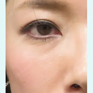 プルージュ美容クリニック 岡本 慎一医師の症例