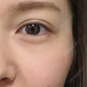 プルージュ美容クリニック 岡本 慎一医師の症例
