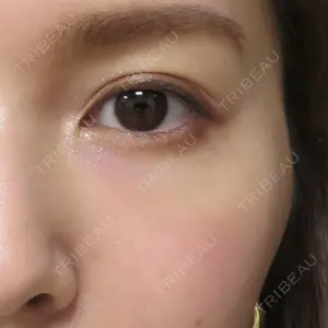 プルージュ美容クリニック 岡本 慎一医師の症例
