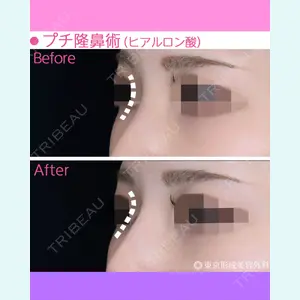 東京形成美容外科 船橋院 山崎 修吾医師の症例