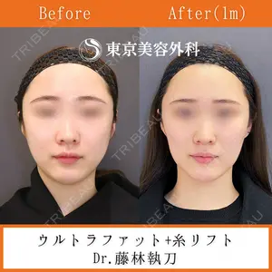 東京美容外科 銀座院 藤林 万里子医師の症例
