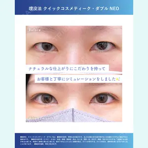 湘南美容クリニック 熊本院 中溝 晃規医師の症例