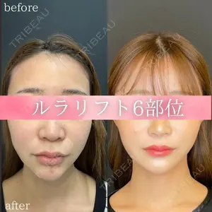 ルラ美容クリニック 名古屋本院 馬場 愛理医師の症例