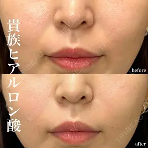 ルラ美容クリニック 名古屋栄院 / ルラスキンクリニック 名古屋栄院 関戸 優医師の症例