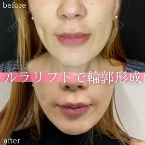 ルラ美容クリニック 名古屋本院 馬場 愛理医師の症例