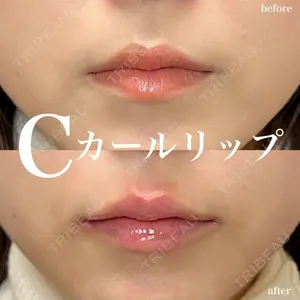 ルラ美容クリニック 名古屋栄院 / ルラスキンクリニック 名古屋栄院 関戸 優医師の症例