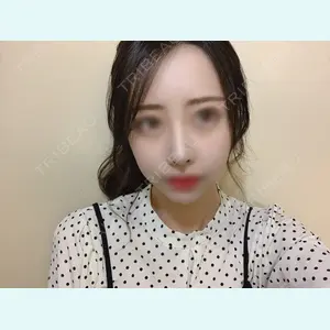 加美（GAMI）整形外科 パク・ゴヌク医師の症例