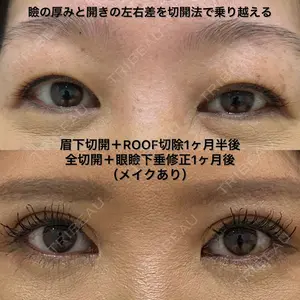 エターナル美容クリニック 久門田 詳医師の症例