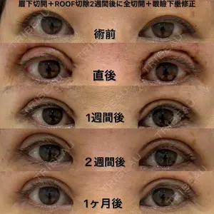 エターナル美容クリニック 久門田 詳医師の症例
