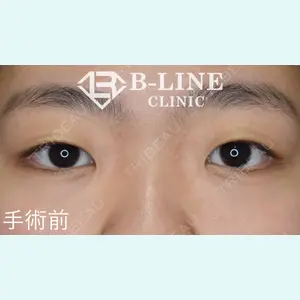 B-LINE CLINIC 池袋院 小池 康弘医師の症例