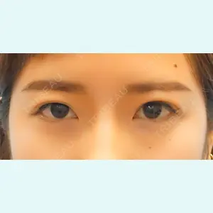 麹町皮ふ科・形成外科クリニックの症例
