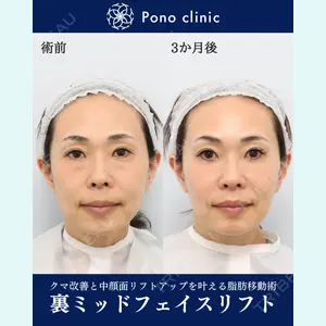Pono clinic 【ポノクリ】 芝 容平医師の症例