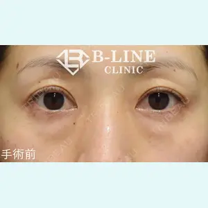 B-LINE CLINIC 池袋院 小池 康弘医師の症例