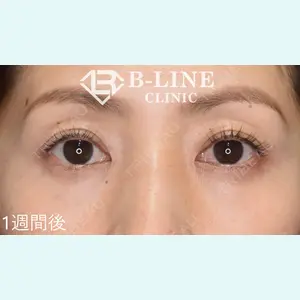 B-LINE CLINIC 池袋院 小池 康弘医師の症例